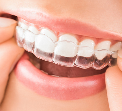 التقويم الشفاف